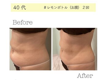 Melrose 銀座店 【メルローズ】/【お客様の効果写真】