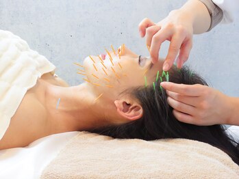 ハリックマ(HARICCUMA)/【人気No1】小顔美容鍼