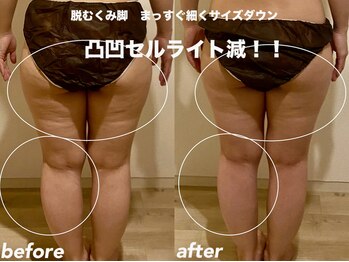 リラクゼーションエステ アジュール(Azur)/【施術12回】