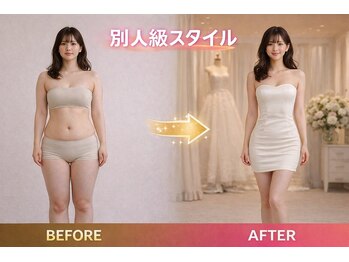 アプロ(Aphro)/別人級スタイル