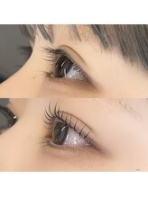 ルミエール(Lumiere)/before/after