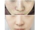 クリア 麻布十番(CLEAR)の写真