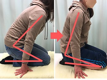 杉本接骨鍼灸院/膝の症状例:施術を受けた方の声