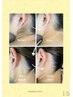 【うなじ脱毛(wax＋光脱毛)】ヘアアップうなじ美人♪結婚式やイベント前に◎
