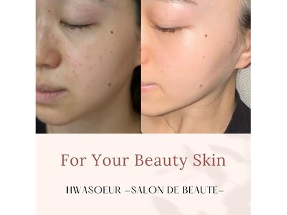ファスール(Hwasoeur)の写真