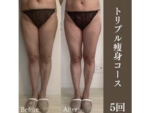 サロンドペシェ(salon de peche)/トリプル痩身コース５回の変化