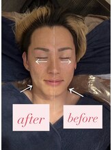 ソルテケア(SORTE*care)/美顔「πフェイシャル」