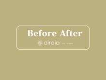 ディレイア ザ コスメ 有楽町マルイ店(direia the cosme)/お客様のBeforeAfter[有楽町駅]