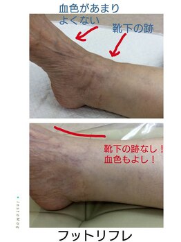ドクターネイル爪革命 江戸川橋店/足首ってむくむとわかりやすい？