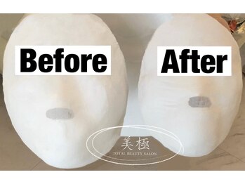 美極 トータルビューティー(美極 TOTAL BEAUTY)/恵比寿/小顔コルギ/エステ/