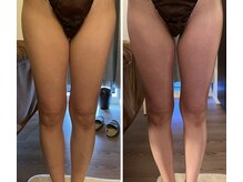 なまえのないエステサロン/☆足の浮腫みにも効果絶大☆