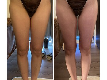 なまえのないエステサロン/☆足の浮腫みにも効果絶大☆