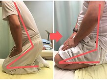 杉本接骨鍼灸院/膝の症状例：施術を受けた方の声