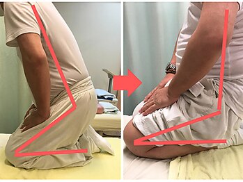 杉本接骨鍼灸院/膝の症状例:施術を受けた方の声