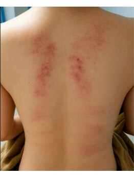 イニティウム 清澄白河(initium)/深効！スライドカッピング女性