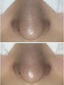 フラリス(fraris)/