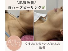 GRACETHOUSAND(グレイスサウザンド)の雰囲気（西宮/甲子園口/ハーブピーリング/毛穴/フェイシャル/シワケア）