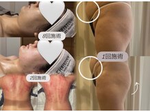 エクラ(eclat)の雰囲気（痩身リアル症例◎実績多数あり！結果重視★二重あご改善も得意）