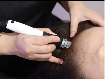 アランクォーツ(aranquarts)の写真