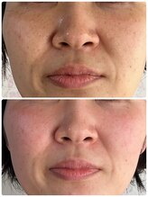 ウィッシュプロサロンケー(WISHpro salon K)/透明感、シミ