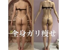 Melrose 銀座店　【メルローズ】/【お客様の効果写真】