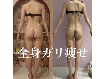 Melrose 銀座店 【メルローズ】/【お客様の効果写真】