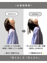 トトノイ(totonoi)/お首の変化