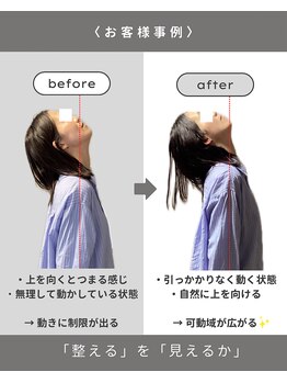 トトノイ(totonoi)/お首の変化