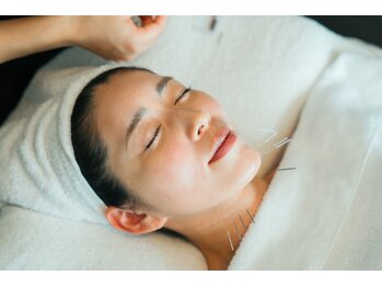 ハチハチ(808)の写真/【相模原エリア希少◆美容鍼】痛みを最小限に抑えたオーダーメイド美容鍼♪たるみ・むくみでお悩みの方に◎