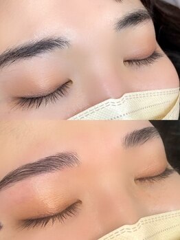 エヌ(enne)/HBL(ハリウッドブロウリフト)