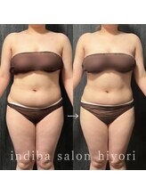 ヒヨリ(hiyori)/《before/after》body