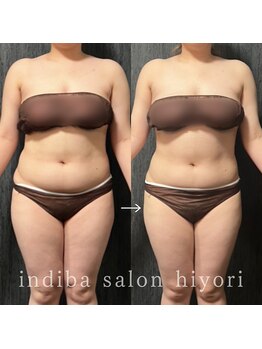 ヒヨリ(hiyori)/《before/after》body