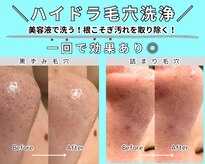 エースタイル(a-style)