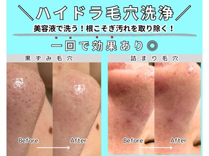 エースタイル(a-style)の写真