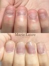 深爪改善/自爪育成/ネイルケア