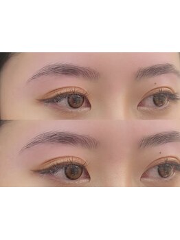 メンズフェイシャル