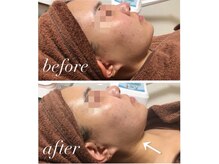 ソレラ(sorelle)/ハイパーナイフ