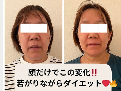 ヨサパーク エー(YOSA PARK A)の写真