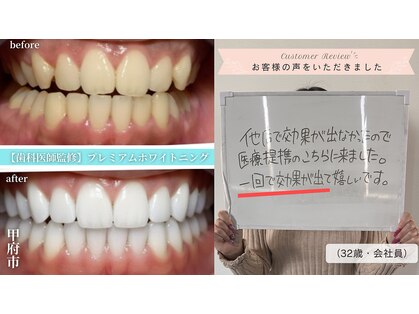 ラフィト(Ra huit)の写真