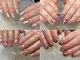 エムジーネイル(Mg Nail)の写真