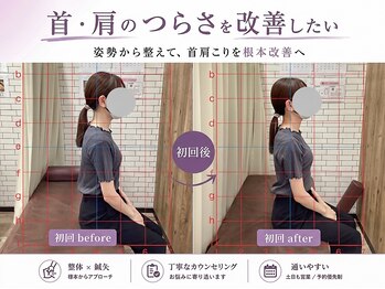 はぴねす鍼灸整骨院 立花院の写真/育児やデスクワークでの肩こり・首の疲れ・眼精疲労・頭痛などお身体の疲労を短時間で改善◎