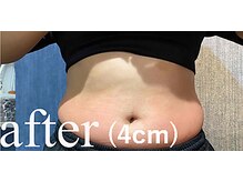 カナウ(kanau)/トリプルボディシェイプ