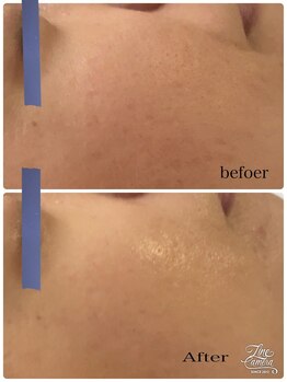 リッチベル(richbelle)/