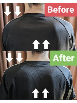 松 中目黒/20代男性 肩こり 眼精疲労改善例