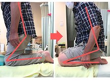 杉本接骨鍼灸院/膝の症状例：施術を受けた方の声