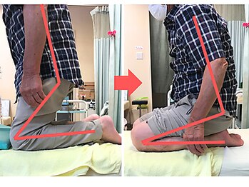 杉本接骨鍼灸院/膝の症状例:施術を受けた方の声