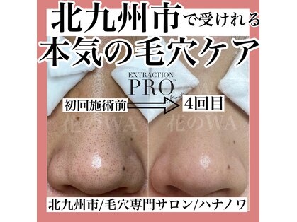 ハナノワ(花のWA)の写真