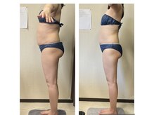 美ボディラボ(美Body Labo)/まずは採寸♪悩みを教えて下さい