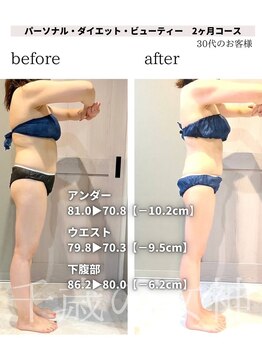 千歳の女神 久屋大通店/【施術風景】Berore/After