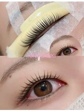 2. ダメージレス施術と高持続力